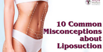 10 misconceptions about liposuction
