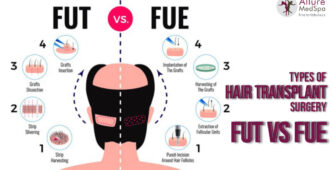 Types of Hair Transplant surgery FUT vs FUE at Allure Medspa andheri mumbai