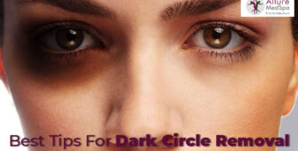 Dark circle removal