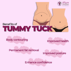 Tummy tuck benefits - fat removal, body contouring, improved posture and confidence