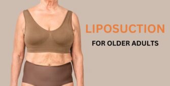 liposuction surgery for older adults a guide about what to expect and to consider