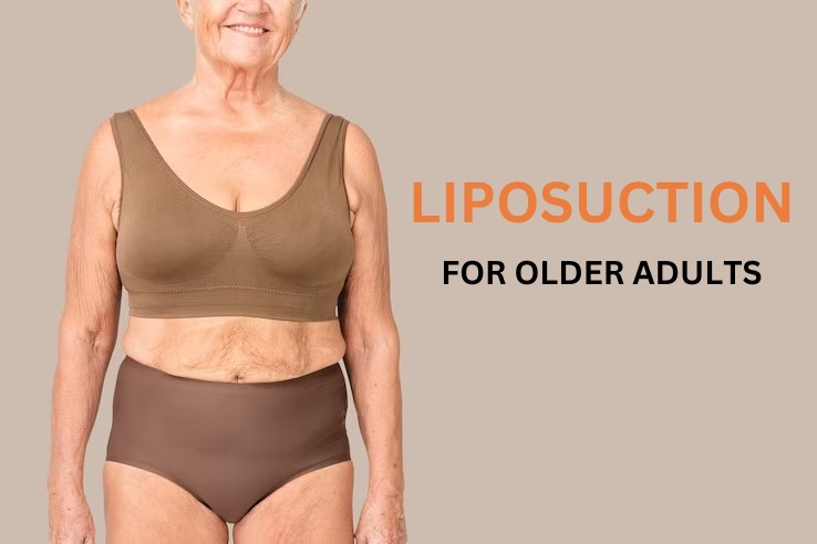 liposuction surgery for older adults a guide about what to expect and to consider