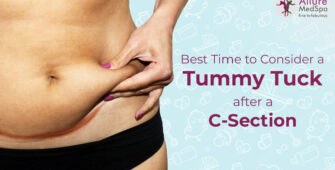 know the right time to consider after cesarean section in mumbai