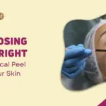 Choosing the right Chemical Peel for Your Skin