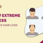 HOW EXTREME STRESS CAUSES HAIR LOSS