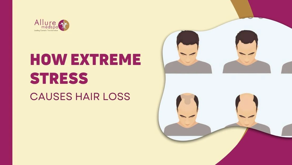 HOW EXTREME STRESS CAUSES HAIR LOSS