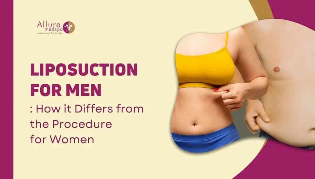 Liposuction for Men: How it Differs from the Procedure for Women