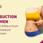 Liposuction for Men How it Differs from the Procedure for Women