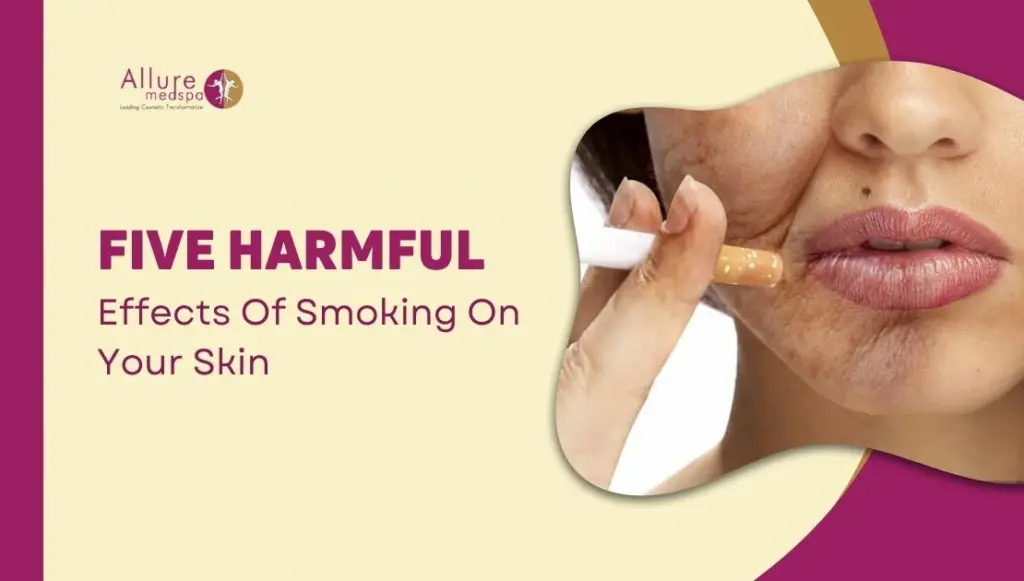 5 Harmful Effects Of Smoking On Your Skin