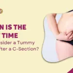 When is the Best Time to Consider a Tummy Tuck after a C-Section