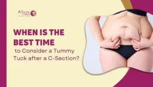 When is the Best Time to Consider a Tummy Tuck after a C-Section