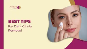 Best Tips For Dark Circle Removal