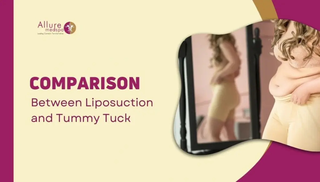 Comparison Between Liposuction and Tummy Tuck