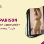 Comparison Between Liposuction and Tummy Tuck