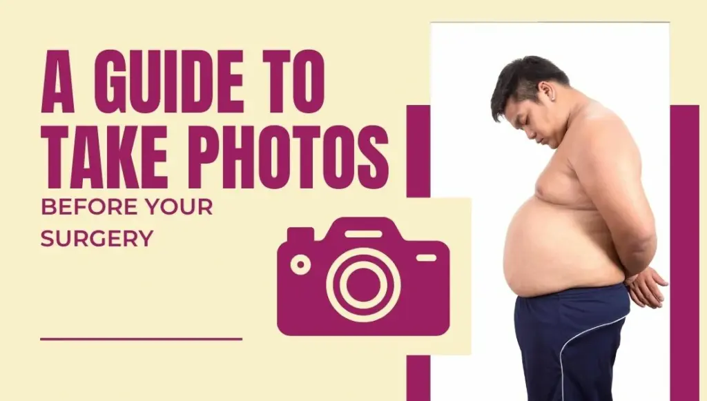 A Guide to Take Photos Before Your Surgery