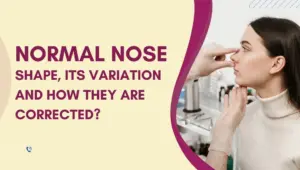 Normal Nose Shape, Its Variation and How They Are Corrected