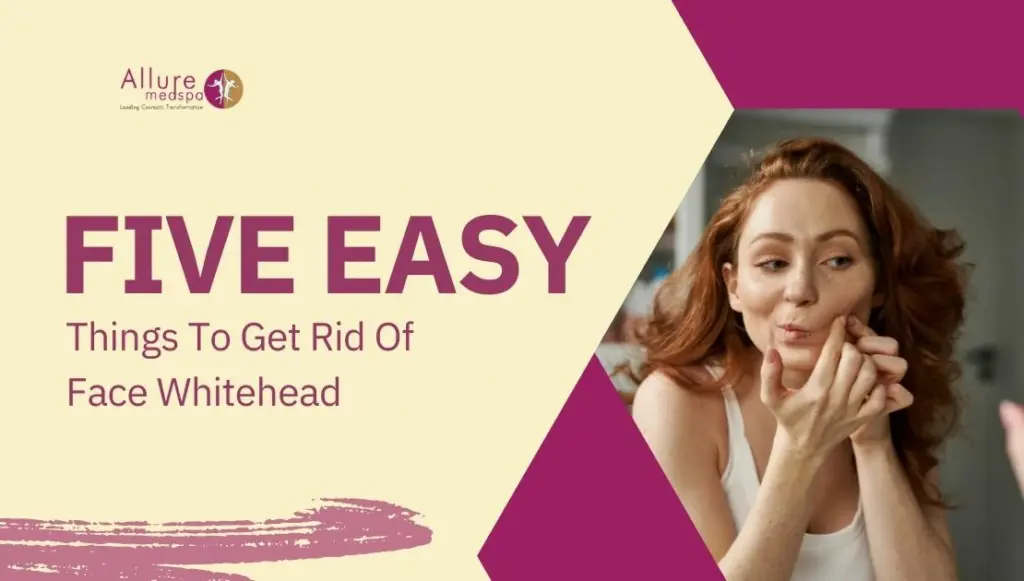 5 Easy Things To Get Rid Of Face Whitehead