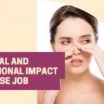 Mental and Emotional Impact of Nose Job