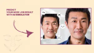 Predict Your Nose Job Result with AI Simulator