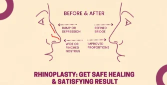 Rhinoplasty Get Safe Healing Satisfying Result