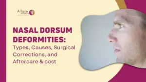 Nasal Dorsum Deformities Types, Causes, Surgical Corrections, and Aftercare & cost