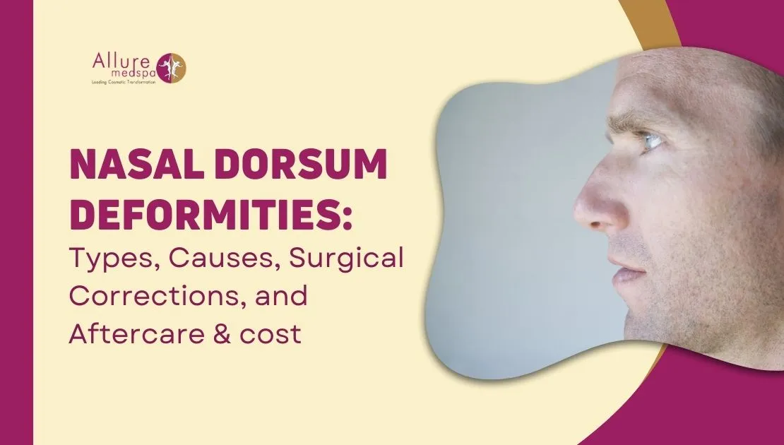 Nasal Dorsum Deformities Types, Causes, Surgical Corrections, and Aftercare & cost