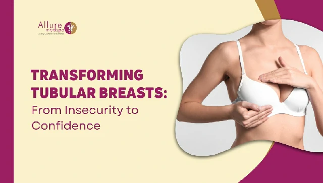 Tubular Breasts: How Breast Implants Can Create Natural, Feminine Contours - AllureMedSpa