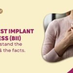 Breast Implant Illness 5 Brest Implant Illness