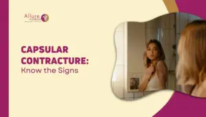 Capsular Contracture blog images