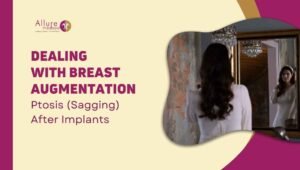 Dealing With Breast Augmentation Ptosis (Sagging) After Implants