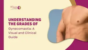 Understanding the Grades of Gynecomastia A Visual and Clinical Guide