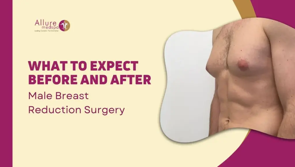 What to Expect Before and After Male Breast Reduction Surgery