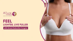 Breast Reduction Surgery 300x170 1