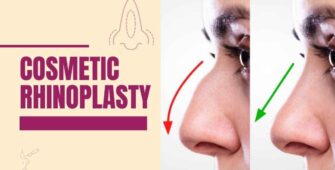 Cosmetic rhinoplasty