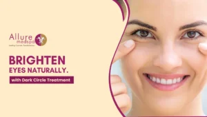 Dark Circle 300x170 1