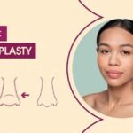 Ethnic Rhinoplasty: Embracing Diversity with Precision 5 Ethnic Rhinoplasty