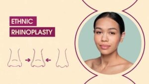 Ethnic Rhinoplasty