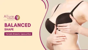 Female Breast Liposuction 300x170 1
