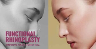 Functional rhinoplasty
