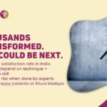 Gynecomastia Surgery Success Rate in India: What You Should Know 5 Gynecomastia Surgery Success Rate in India_ What You Should Know