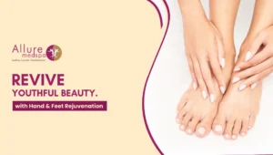 Hand Feet Rejuvenation 300x170 1