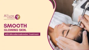 Microdermabrassion Treatment 300x170 1