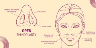 Open Rhinoplasty