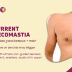 Recurrent Gynecomastia: Why It Happens & How to Fix It Permanently 1 Recurrent Gynecomastia Why It Happens & How to Fix It Permanently