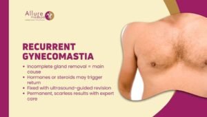 Recurrent Gynecomastia Why It Happens & How to Fix It Permanently