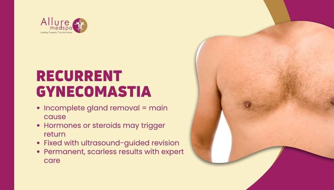 Recurrent Gynecomastia Why It Happens & How to Fix It Permanently