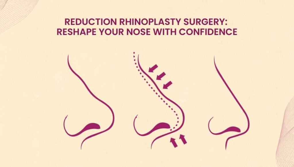 Reduction Rhinoplasty Surgery: Reshape Your Nose with Confidence