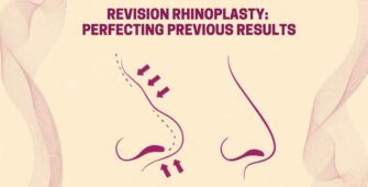 Revision rhinoplasty