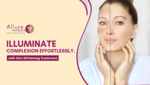 Skin Whitening Treatment 300x170 1
