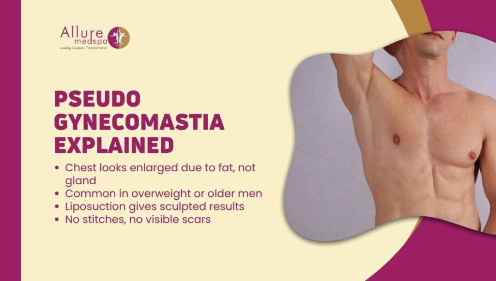 What Is Pseudo Gynecomastia? Causes, Diagnosis & Treatment